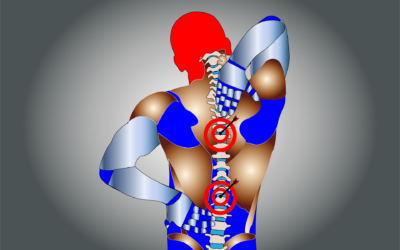 Le dos : les causes des tensions et les solutions
